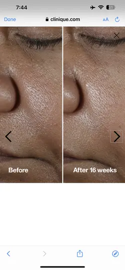 سرم ترمیم کننده و ضد چروک و کلاژن ساز  5mil smart کلینیک اورجینال