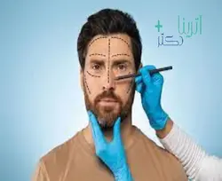 بوتاکس پیشانی