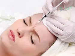 بوتاکس رفع اخم