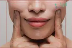 فیلر آرگ گونه