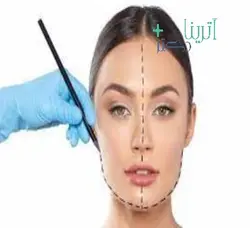 فیلر زاویه فک