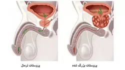 معجون پروستات شریفه