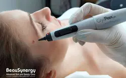 کرایو پن مناسب درمان زگیل، خال ،میخچه