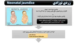 لوح فشرده ماژور 2 (DVD DarmanX Major 2) (اطفال-زنان-قلب)