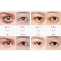 کرم دور چشم طلا خاویار