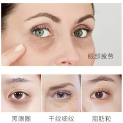 کرم دور چشم طلا خاویار