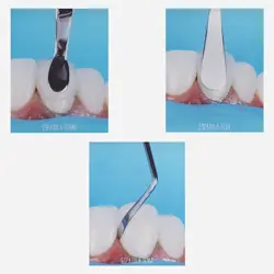 کیت قلم های کامپوزیت شیپ / Prof. Rafael Calixto Composite Shape Kit