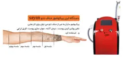 دستگاه لیزر پیکوشور پیکو ثانیه نقطه زن برند سایان
