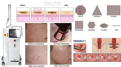 دستگاه لیزر زیبایی و جوانسازی پوست ایستاده c02 فرکشنال فوتونا Fotona Fractional Co2