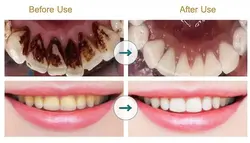 جرم گیر دندان برقی skyfie 3639