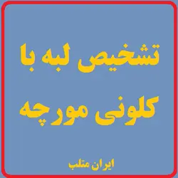 MP06 – تشخیص لبه با الگوریتم کلونی مورچه