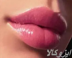 خدمات تخصصی ژل و بوتاکس | ایزو کالا | بازار نیازمندیهای آنلاین ایران