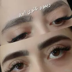 ریموو ، پاک کردن تاتو ابرو