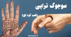 دوره سوجوک تراپی