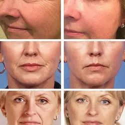 پد کلاژن ساز جذبی HighPrime کره ای