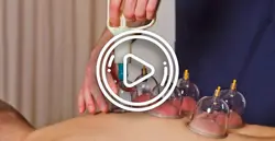 آموزش بادکش درمانی