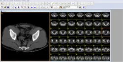 دانلود نرم افزار ۳D-Doctor.v5