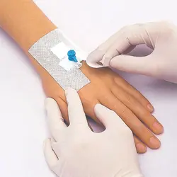چسب آنژیوکت