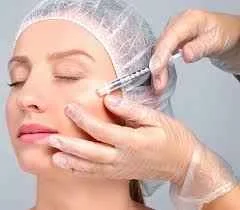 تزریق فیلر گونه و خط خنده