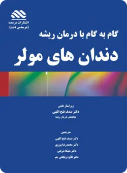 گام به گام با درمان ریشه دندان های مولر (بدون ویدئوی آموزشی)