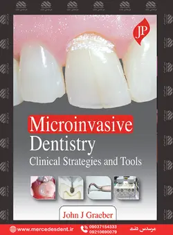 Microinvasive Dentistry Clinical Strategies and Tools