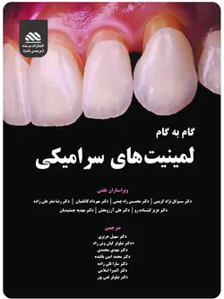 گام به گام لمینیت های سرامیکی (بدون ویدئوی آموزشی)