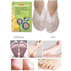 ماسک لایه بردار و نرم کننده پا پیوردرم