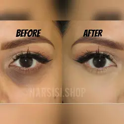 کانسیلر آرت اسکین