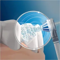 مسواک برقی اورال بی مدل oxyjet 5000