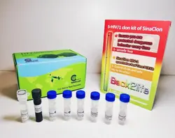 کیت تشخیص ایدز -STRP HIV Detection Kit-20T-PK3121