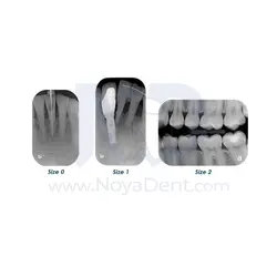 اسکنر فسفرپلیت ایرتکنیک Air Techniques مدل Scan X Edge