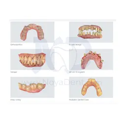 اسکنر داخل دهانی شاینینگ Shining 3D