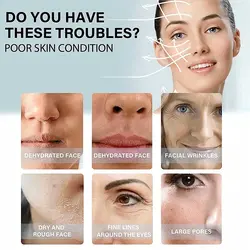 نخ کلاژن ساز جذبی بدون تزریق کره ای EELHOE