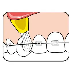 مسواک اینتراسپیس TePe (4 عددی)