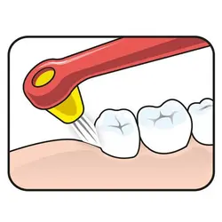 مسواک اینتراسپیس TePe (4 عددی)