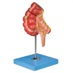 مولاژ آپاندیس و روده کور