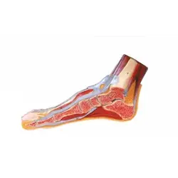 مولاژ برش پا