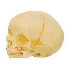 مولاژ جمجمه نوزاد