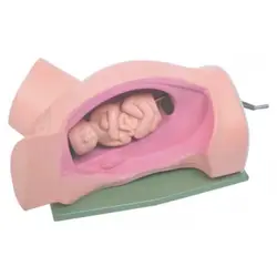 مولاژ چرخش جنین در هنگام زایمان