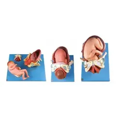 مولاژ مراحل زایمان