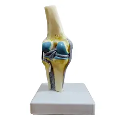 مولاژ مفصل زانو