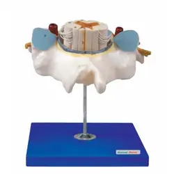 مولاژ نخاع درون مهره