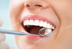 عکس با کیفیت تبلیغاتی دندان های ردیف بالا دهان و چک کردن آن با آینه