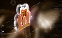 عکس با کیفیت تبلیغاتی ماکت برای نشان دادن عصب های دندان