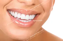 عکس با کیفیت تبلیغاتی لب های خندان خانم زیبا با دندان هایی سفید