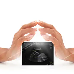عکس با کیفیت برگه سونوگرافی جنین در دستان مادر
