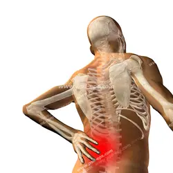 عکس با کیفیت اسکلت انسان و مشخص کردن محل درد موضعی و اسکلتی ناحیه کمر