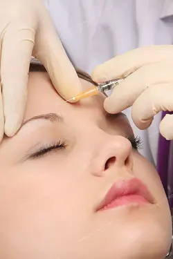 عکس با کیفیت تزریق ژل و بوتاکس توسط پزشک جهت رفع خط اخم و خط پیشانی و چروک پوست برای بانوان