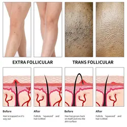 براش لايه بردار بدن داخل حمام  مينيسواورجینالMassaging Exfoliating Body Brush