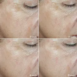 ست کلاژن ساز و ضدپیری نوایج NOVAGE